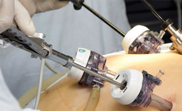 Best Prostate Laser Surgeon In India, Laser Surgery