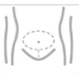 Urology Treatment In Calicut
