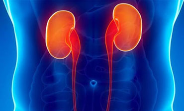 Kidney Stone Treatment in Calicut, Kidney Stone